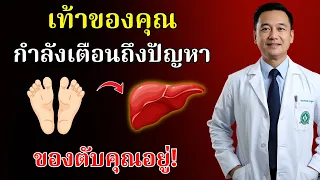 เส้นเลือดฝอยที่ขยายตัวคล้ายใยแมงมุม (Spider Veins) บนขาหรือใบหน้า บ่งบอกถึงภาวะใดของตับ