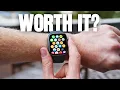Is The Apple Watch Series 11 WORTH The Upgrade Full Review