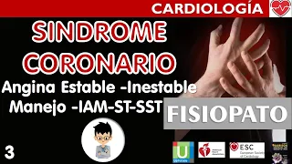 ANGINA ESTABLE INESTABLE, MANEJO del IAM con y sin ELEVACIÓN ST Complicaciones, Síndrome Coronario|3