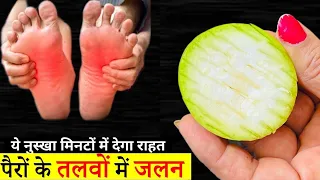 हाथ और पैरों के तलवे की जलन से छुटकारा पाए, पहली बार से ही मिलेगा आराम Feet Inflammation