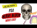 Posterior Superior Alveolar Nerve Block ORAL SURGERY LECTURES