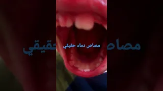 مصاص دماء حقيقي Shorts 