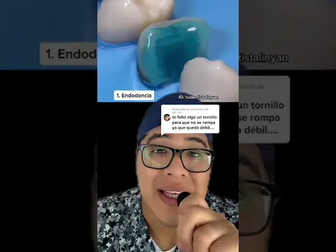 Download MP3 INCREIBLE reconstrucción de diente dañado por caries🦷🤓