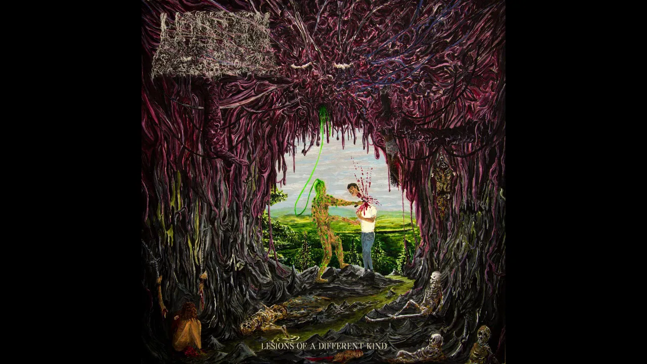 Undeath : Lesions of a Different Kind Full Album (Death Metal-2020)