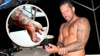 ATTACKED BY A DOG IN PAPUA NEW GUINEA!  👀 – (Episode 298)