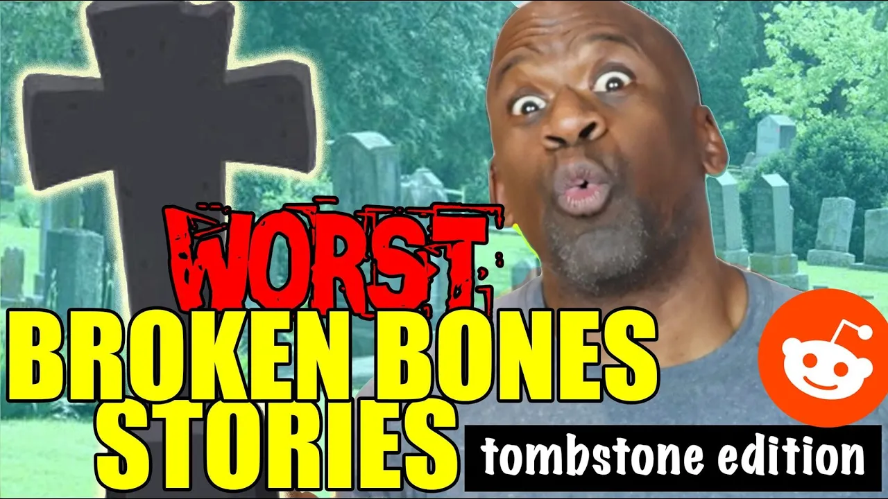 The Worst BROKEN BONES STORIES ON REDDIT (r/brokenbones) | DR. CHRIS