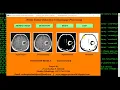Python Code for Brain Tumor Detection Using Image Processing Final Year Project IEEE Project