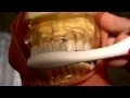 4 Brushing Techniques Bass Charters Modified Stillman Fones