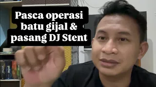 kidney stone surgery u0026 dj stent installation experience