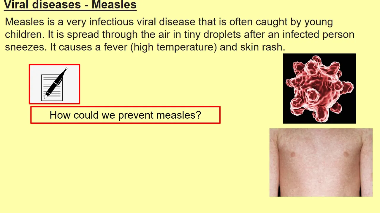 Types of Pathogens and Diseases