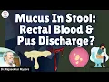 Mucus In Stool Rectal Blood Pus Discharge Everything You Need To Know Dr Rajasekhar Mysore