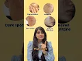 Download Lagu Skincare for Pigmentation and Uneven Skintone | Sunscreen for Pigmented skin | Dark Spots, Melasma