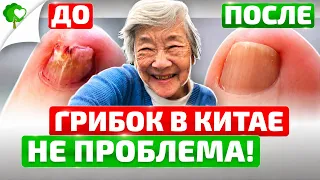 Вот как за 20 мин в китайской народной медицине избавляются от грибка ногтей