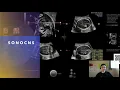 Accelerated graphics and compute API for Machine Learning - DirectML