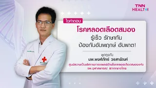 การรักษาโรคหลอดเลือดสมองชนิดขาดเลือดทำอย่างไรบ้าง