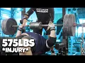 PULLED PEC ON 575LB BENCH PRESS