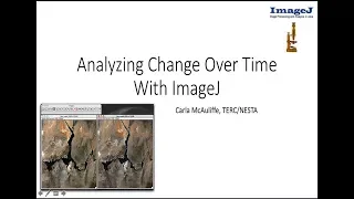 Out2Lunch ImageJ - Image processing and Analysis in Java