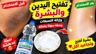 الخل والنشا ‼️يزيل سواد 20 سنة تبييض للابد ‼️للأيد والجسم كله في 5 دقائق
