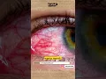 Download Lagu Kenapa KETIKA NANGIS MATA MERAH? #shorts