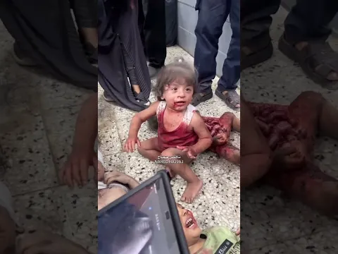 اطفال غزة الان 💔