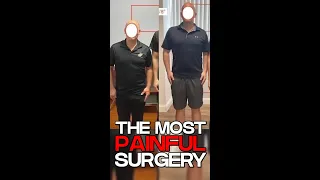 Height Enhancement Surgery S Excruciatingly Painful Procedure EXPLAINED 