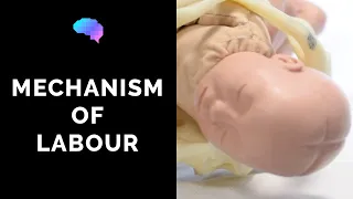 mechanism of labour u0026 fetal positions osce guide ukmla cpsa plab 2