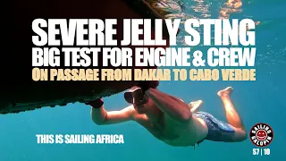 Big Test For Engine & Crew | A Severe Jelly Sting | Sailing Dakar To Cabo Verde Africa | S7 Epsd 10