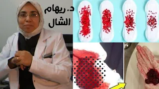                                                                                                دندنها