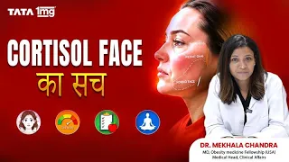 Cortisol Face सच है या सिर्फ़ Internet Trend? जानिए असली वजह