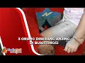 Download Lagu 3 Korban Gigitan Anjing di Bukittinggi Jalani Rawat Jalan