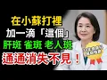 Download Lagu 67歲皮膚科醫生，僅花120台幣就祛除了雀斑和瑕疵。一定要記住這個組合！