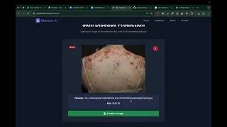 AI Skin Cancer Detection System Deep Learning Project Python