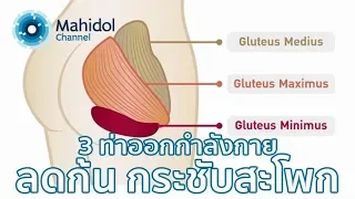 สาเหตุหลักของก้นย้อยคืออะไร และสามารถแก้ไขได้หรือไม่