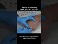 Download Lagu IV Insertion \u0026 Blood Draw Tip: Don't Anchor Veins Like This (Use This Instead)