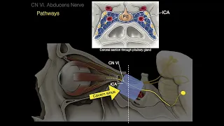 Cranial Nerve VI: Abducens nerve and Clinical correlations
