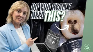 Do You REALLY Need a Root Canal Dentist Reveals the Truth