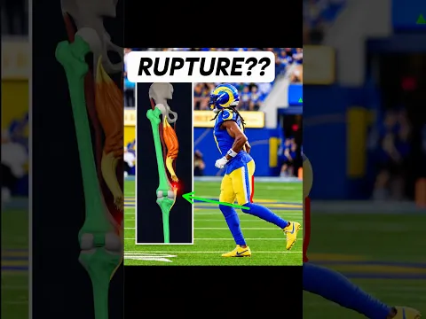 Davante Adams’ RARE & UNUSUAL Hamstring Rupture | Doctor Explains!
