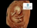 16 WEEK LIVE 4D ULTRASOUND