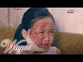Wagas Ang nasunog na balat ni Galea