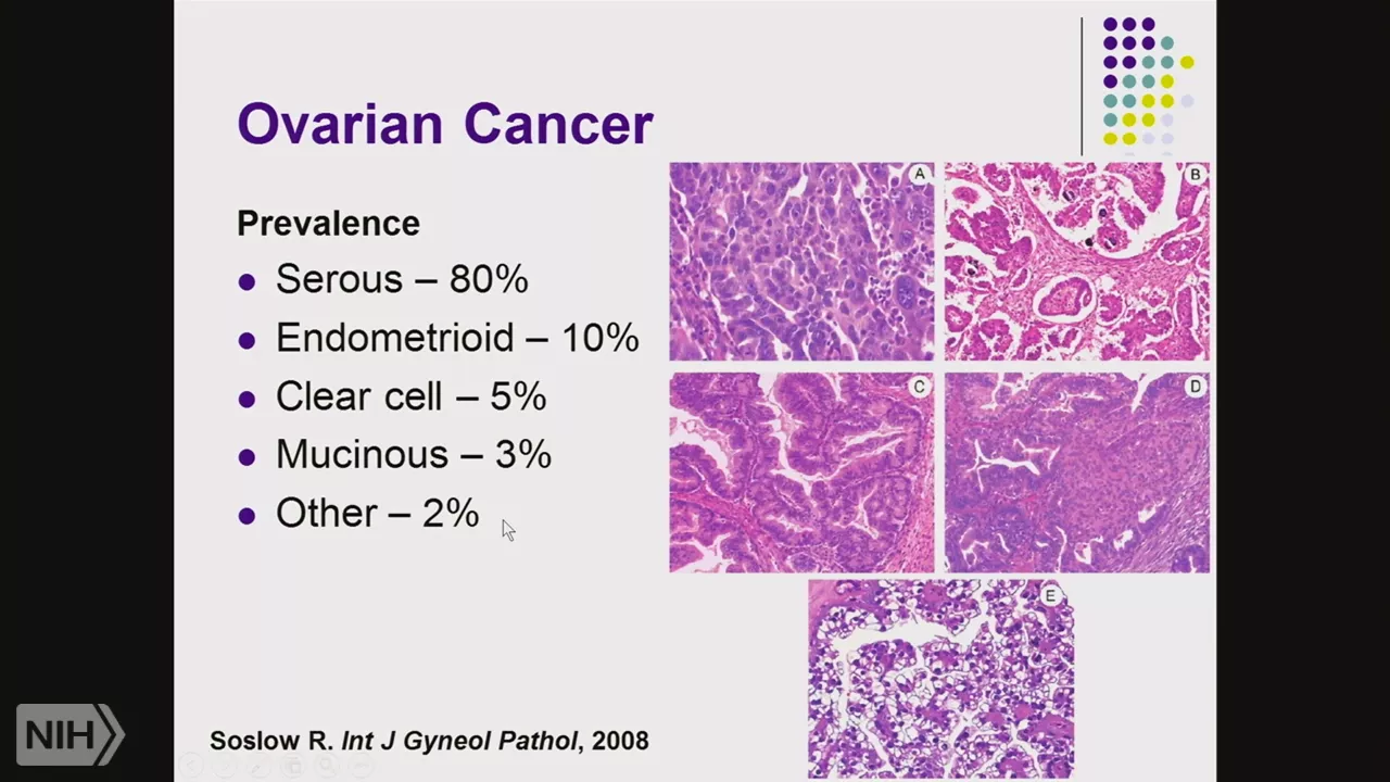 TRACO 2017 - Ovarian Cancer in the Genomics Era and Immune checkpoints