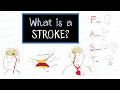 Lagu What is a Stroke? (HealthSketch)