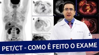 pet scan ou pet ct como feito o exame imeb