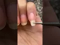 Temporarily Quickly Fixing my Broken Nail Ohhh Noo Ouchhhh