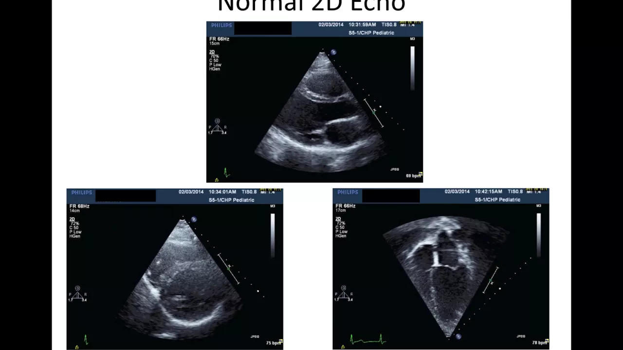 Exploring Cardiac Imaging