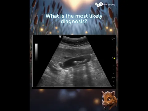 What is the most likely diagnosis? 🔍💡