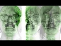 Supergrass - Pumping On Your Stereo (Official Audio)