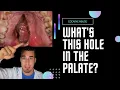 Download Lagu 😲 THIS happened for COCAINE ABUSE - DRUGS side effects #shorts