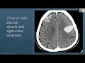 Introduction to Stroke Imaging Zlochower