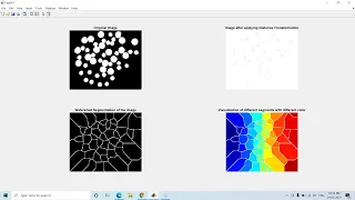 Example of Segmentation using Watershed Algorithm in Matlab