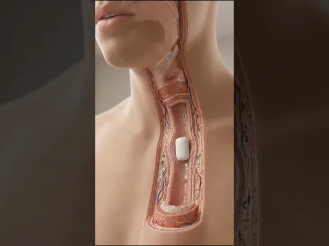 What Will Happen If You Swallow a Chewing Gum #Shorts